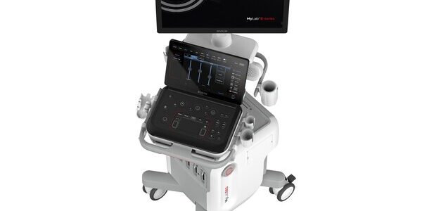 Esaote MyLab E80 ultrasound device